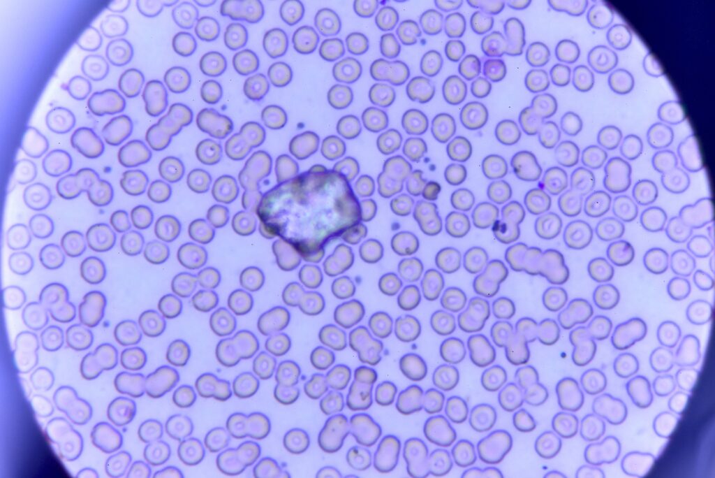 Human skin cells turned into eggs in fertility breakthrough